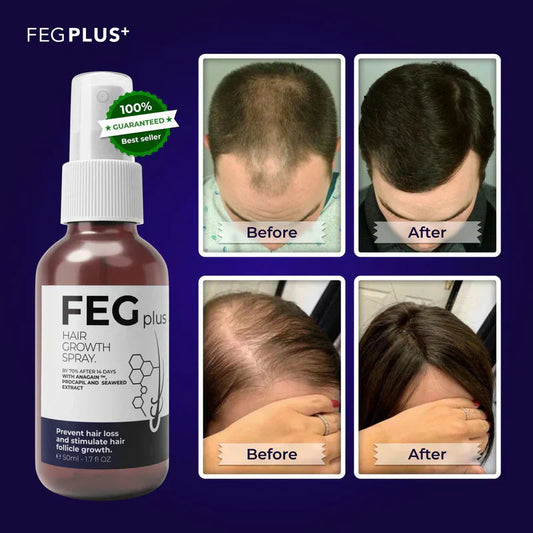 FEG PLUS Hair Growth Spray ( Made in USA )